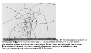 Поле миокарда.jpg